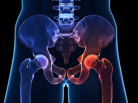 Back Pain